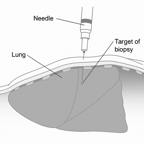 ct-guided-biopsy