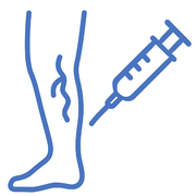 sclerotherapy