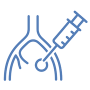 transarterial-chemoembolization